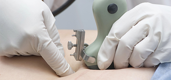 ¿El seguro de salud de MAPFRE cubre la amniocentesis?