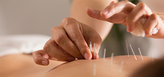 ¿El Seguro de Salud cubre la acupuntura?