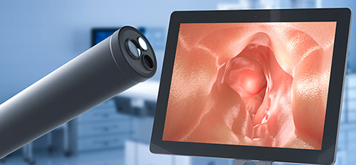 Médico realizando endoscopia digestiva