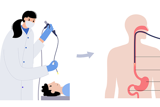 dibujo medico haciendo endoscopia
