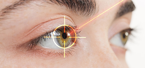 ¿Cubre el seguro médico la operación de miopía?