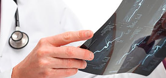 Las lesiones traumatológicas, las que más requieren la intervención de los seguros de viajes