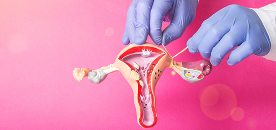 Cobertura de ligadura de trompas MAPFRE Salud