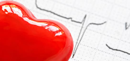 Cómo reconocer un infarto de miocardio